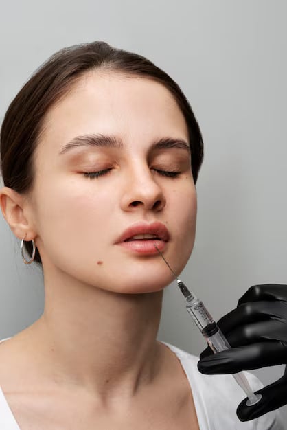 Dermal Fillers