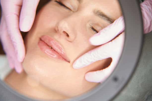 Dermal Fillers